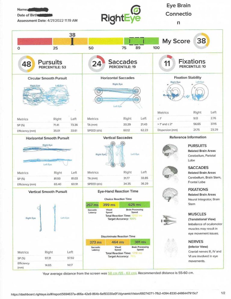 Neuro-opt Eye Exam - Eye Brain Connection